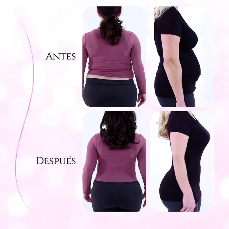 Prenda moldeadora control de abdomen y glúteos - Velform Cross Compression Shaper